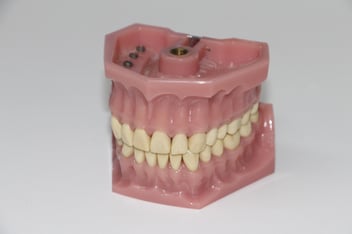 dentures-1514697_1920.jpg