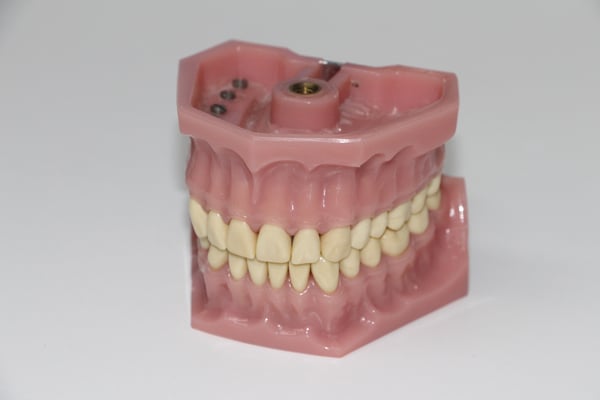 dentures-1514697_1920.jpg
